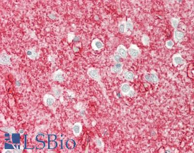 AQP4 / Aquaporin 4 Antibody - Human Brain, Cortex: Formalin-Fixed, Paraffin-Embedded (FFPE)