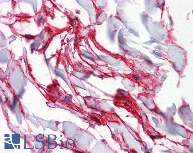 AQP8 / Aquaporin 8 Antibody - Anti-AQP8 / Aquaporin-8 antibody IHC of human colon, connective tissue. Immunohistochemistry of formalin-fixed, paraffin-embedded tissue after heat-induced antigen retrieval. Antibody concentration 5 ug/ml.