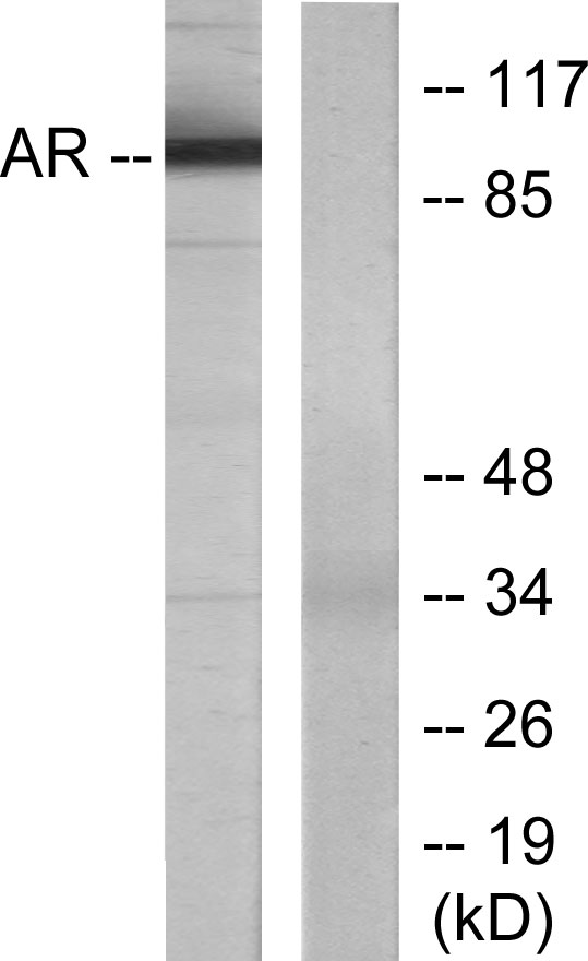 AR / Androgen Receptor Antibody - Western blot analysis of lysates from LOVO cells, using Androgen Receptor Antibody. The lane on the right is blocked with the synthesized peptide.