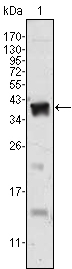 AR / Androgen Receptor Antibody - Western blot using Androgen receptor monoclonal antibody against human Androgen receptor (AA: 221-321) recombinant protein. (Expected MW is 40 kDa)