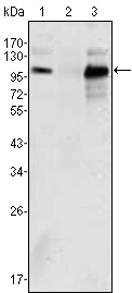 AR / Androgen Receptor Antibody - Western blot using Androgen receptor mouse monoclonal antibody against K562 (1), Jurkat (2) and LNCaP (3) cell lysate.
