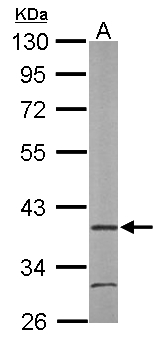 ARA9 / AIP Antibody - Sample (50 ug of whole cell lysate). A: Mouse brain. 10% SDS PAGE. ARA9 / AIP antibody diluted at 1:1000.