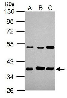 ARA9 / AIP Antibody - ARA9 antibody [N1C3] detects ARA9 protein by Western blot analysis. A. 30 ug HeLa whole cell lysate/extract. B. 30 ug Molt-4 whole cell lysate/extract. C. 30 ug Raji whole cell lysate/extract. 10 % SDS-PAGE. ARA9 antibody [N1C3] dilution:1:5000