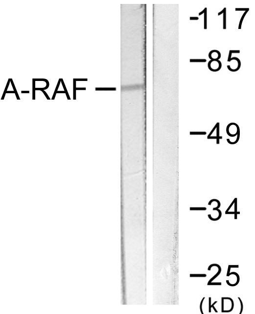 ARAF / ARAF1 / A-RAF Antibody - Western blot analysis of lysates from HeLa cells, treated with PMA 125ng/ml 30', using A-RAF Antibody. The lane on the right is blocked with the synthesized peptide.