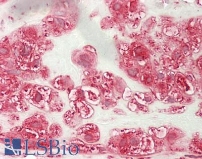 ARF4 Antibody - Human Placenta: Formalin-Fixed, Paraffin-Embedded (FFPE)