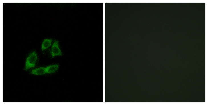 ARFIP1 Antibody - Immunofluorescence analysis of A549 cells, using ARFIP1 Antibody. The picture on the right is blocked with the synthesized peptide.
