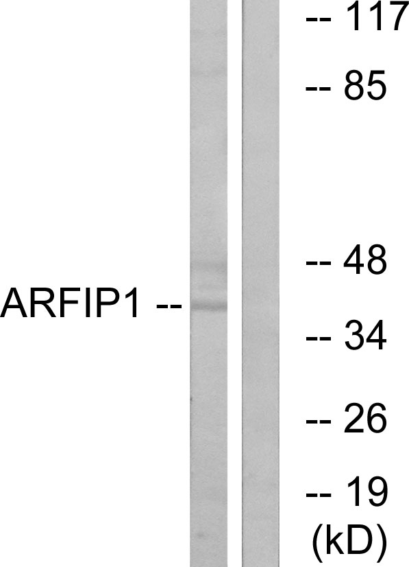 ARFIP1 Antibody - Western blot analysis of lysates from Jurkat cells, using ARFIP1 Antibody. The lane on the right is blocked with the synthesized peptide.