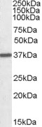ARG1 / Arginase 1 Antibody - ARG1 antibody (0.01 ug/ml) staining of Human Liver lysate (35 ug protein/ml in RIPA buffer). Primary incubation was 1 hour. Detected by chemiluminescence.