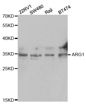 ARG1 / Arginase 1 Antibody - Western blot analysis of extracts of various cell lines.