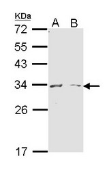 ARG1 / Arginase 1 Antibody - Sample (30 ug of whole cell lysate). A: Molt-4. B: Raji. 12% SDS PAGE. ARG1 antibody diluted at 1:1000. 
