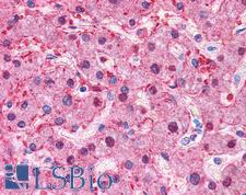 ARG1 / Arginase 1 Antibody - Anti-ARG1 antibody IHC of human liver. Immunohistochemistry of formalin-fixed, paraffin-embedded tissue after heat-induced antigen retrieval. Antibody concentration 5 ug/ml.  This image was taken for the unconjugated form of this product. Other forms have not been tested.