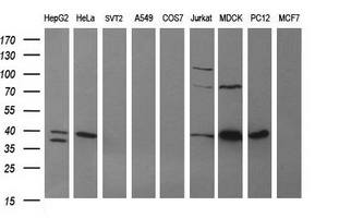 ARG2 / Arginase 2 Antibody - Western blot of extracts (35ug) from 9 different cell lines by using anti-ARG2 monoclonal antibody (HepG2: human; HeLa: human; SVT2: mouse; A549: human; COS7: monkey; Jurkat: human; MDCK: canine; PC12: rat; MCF7: human).