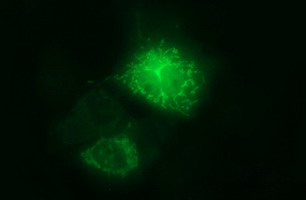 ARG2 / Arginase 2 Antibody - Anti-ARG2 mouse monoclonal antibody immunofluorescent staining of COS7 cells transiently transfected by pCMV6-ENTRY ARG2.