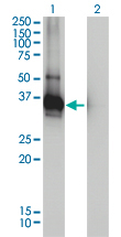 ARH / LDLRAP1 Antibody - Western blot of LDLRAP1 expression in transfected 293T cell line by LDLRAP1 monoclonal antibody, clone 4G4-D5.