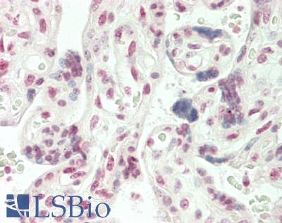 ARHGAP17 / NADRIN Antibody - Human Placenta: Formalin-Fixed, Paraffin-Embedded (FFPE)