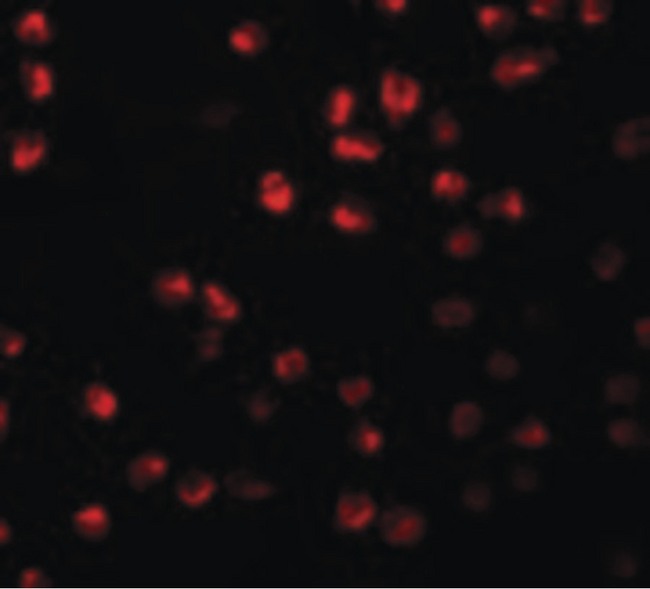 ARHGAP18 Antibody - Immunofluorescence of ARHGAP18 in 3T3 cells with ARHGAP18 antibody at 20 ug/ml.