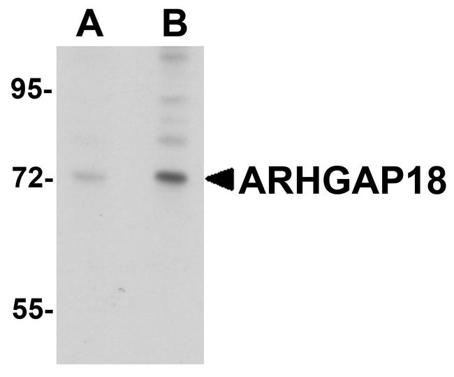 ARHGAP18 Antibody - Western blot analysis of ARHGAP18 in 3T3 cell lysate with ARHGAP18 antibody at (A) 1 and (B) 2 ug/ml.