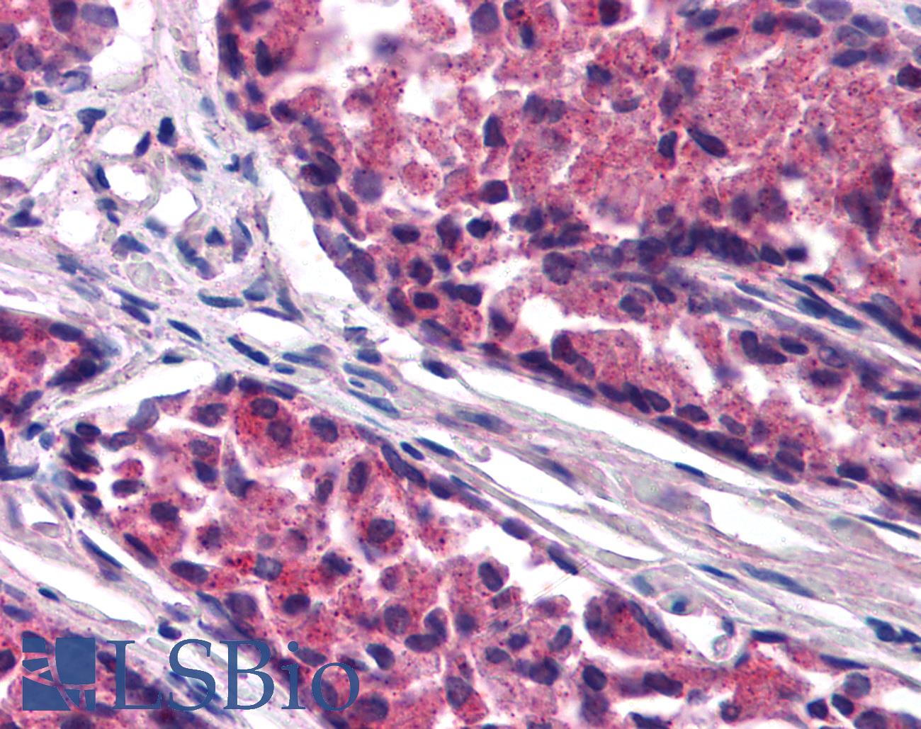ARHGAP33 / SNX26 Antibody - Anti-ARHGAP33 / SNX26 antibody IHC of human prostate. Immunohistochemistry of formalin-fixed, paraffin-embedded tissue after heat-induced antigen retrieval. Antibody concentration 25 ug/ml.