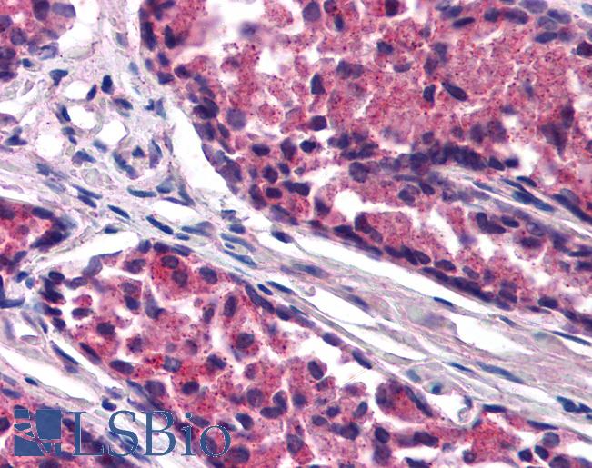 ARHGAP33 / SNX26 Antibody - Anti-ARHGAP33 / SNX26 antibody IHC of human prostate. Immunohistochemistry of formalin-fixed, paraffin-embedded tissue after heat-induced antigen retrieval. Antibody concentration 25 ug/ml.