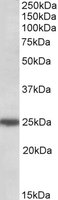 ARHGDIG / RHOGDI-3 Antibody - ARHGDIG antibody (0.5 ug/ml) staining of HeLa lysate (35 ug protein/ml in RIPA buffer). Primary incubation was 1 hour. Detected by chemiluminescence.