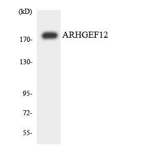 ARHGEF12 Antibody - Western blot analysis of the lysates from HUVECcells using ARHGEF12 antibody.