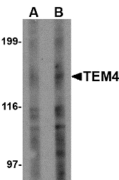 ARHGEF17 / TEM4 Antibody - Western blot of TEM4 in Jurkat Cell lysate with TEM4 antibody at (A) 1 and (B) 2 ug/ml. Below: Immunohistochemistry of TEM4 in human spleen tissue with TEM4 antibody at 2.5 ug/ml.