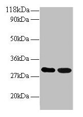 ARHGEF18 Antibody - Western blot All lanes: Rho guanine nucleotide exchange factor 18 antibody at 2µg/ml Lane 1: EC109whole cell lysate Lane 2: 293T whole cell lysate Secondary Goat polyclonal to rabbit IgG at 1/15000 dilution Predicted band size: 131, 115 kDa Observed band size: 30, 60 kDa
