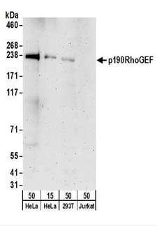 ARHGEF28 Antibody - Detection of Human p190RhoGEF by Western Blot. Samples: Whole cell lysate from HeLa (15 and 50 ug), 293T (50 ug), and Jurkat (50 ug) cells. Antibodies: Affinity purified rabbit anti-p190RhoGEF antibody used for WB at 0.4 ug/ml. Detection: Chemiluminescence with an exposure time of 3 minutes.