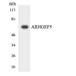 ARHGEF5 Antibody - Western blot analysis of the lysates from K562 cells using ARHGEF5 antibody.