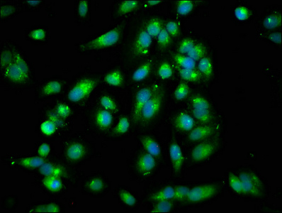 ARHGEF7 Antibody - Immunofluorescence staining of Hela cells with ARHGEF7 Antibody at 1:250, counter-stained with DAPI. The cells were fixed in 4% formaldehyde, permeabilized using 0.2% Triton X-100 and blocked in 10% normal Goat Serum. The cells were then incubated with the antibody overnight at 4°C. The secondary antibody was Alexa Fluor 488-congugated AffiniPure Goat Anti-Rabbit IgG(H+L).