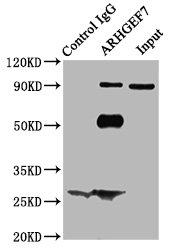ARHGEF7 Antibody - Immunoprecipitating ARHGEF7 in Hela whole cell lysate Lane 1: Rabbit control IgG (1µg) instead of ARHGEF7 Antibody in Hela whole cell lysate.For western blotting, a HRP-conjugated Protein G antibody was used as the secondary antibody (1/2000) Lane 2: ARHGEF7 Antibody (6µg) + Hela whole cell lysate (500µg) Lane 3: Hela whole cell lysate (10µg)