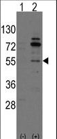 ARHGEF9 / Collybistin Antibody - Western blot of Arhgef9 (arrow) using rabbit polyclonal Arhgef9 Antibody. 293 cell lysates (2 ug/lane) either nontransfected (Lane 1) or transiently transfected with the Arhgef9 gene (Lane 2) (Origene Technologies).
