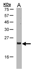 ARL2 Antibody - Sample(30 g of whole cell lysate). A: H1299. 15% SDS PAGE. ARL2 antibody diluted at 1:1000.
