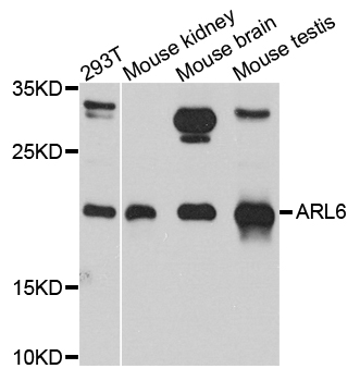 ARL6 Antibody - Western blot blot of extracts of various cell lines, using ARL6 antibody.