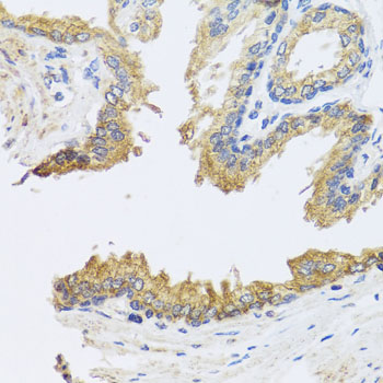 ARL6 Antibody - Immunohistochemistry of paraffin-embedded human prostate using ARL6 antibody at dilution of 1:100 (x40 lens).