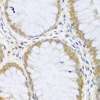 ARL6 Antibody - Immunohistochemistry of paraffin-embedded human colon using ARL6 antibody at dilution of 1:100 (x40 lens).