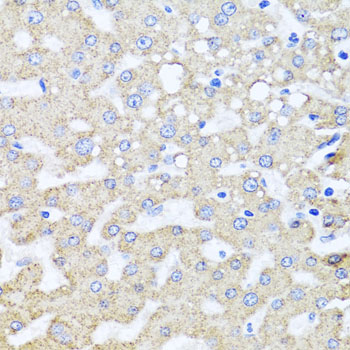 ARL6 Antibody - Immunohistochemistry of paraffin-embedded human liver injury using ARL6 antibody at dilution of 1:100 (x40 lens).
