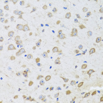 ARL6 Antibody - Immunohistochemistry of paraffin-embedded mouse brain using ARL6 antibody at dilution of 1:100 (x40 lens).