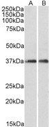 ARPC1A Antibody - Goat Anti-ARPC1A Antibody (0.1µg/ml) staining of fetal Mouse Brain (A) and adult Rat Brain (B) lysates (35µg protein in RIPA buffer). Primary incubation was 1 hour. Detected by chemiluminescencence.