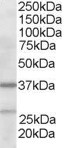 ARPC1B / p41-ARC / ARP2 Antibody - Antibody staining (2 ug/ml) of Human Liver lysate (RIPA buffer, 35 ug total protein per lane). Primary incubated for 1 hour. Detected by Western blot of chemiluminescence.