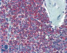 ARPC1B / p41-ARC / ARP2 Antibody - Human Spleen: Formalin-Fixed, Paraffin-Embedded (FFPE)