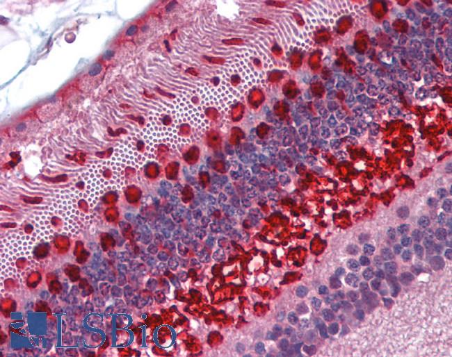 ARR3 / Cone Arrestin Antibody - Anti-ARR3 / Cone Arrestin antibody IHC staining of human eye, retina. Immunohistochemistry of formalin-fixed, paraffin-embedded tissue after heat-induced antigen retrieval.