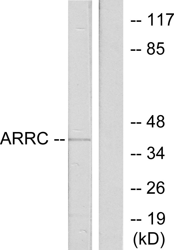 ARR3 / Cone Arrestin Antibody - Western blot analysis of lysates from LOVO cells, using ARRC Antibody. The lane on the right is blocked with the synthesized peptide.