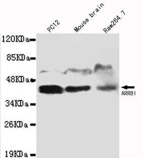 ARRB1 / Beta Arrestin 1 Antibody - Western blot detection of ARRB1 in PC12,Mouse brain&Raw264.7 cell lysates and using ARRB1 antibody (1:1000 diluted).