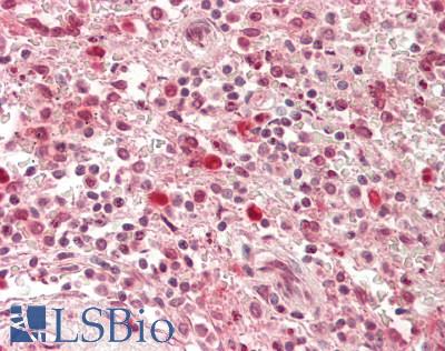 ARRB1 / Beta Arrestin 1 Antibody - Human Spleen: Formalin-Fixed, Paraffin-Embedded (FFPE)