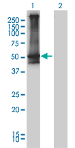 ARRB2 / Beta Arrestin 2 Antibody - Western blot of ARRB2 expression in transfected 293T cell line. Lane 1: ARRB2 transfected lysate (46 KDa). Lane 2: Non-transfected lysate.