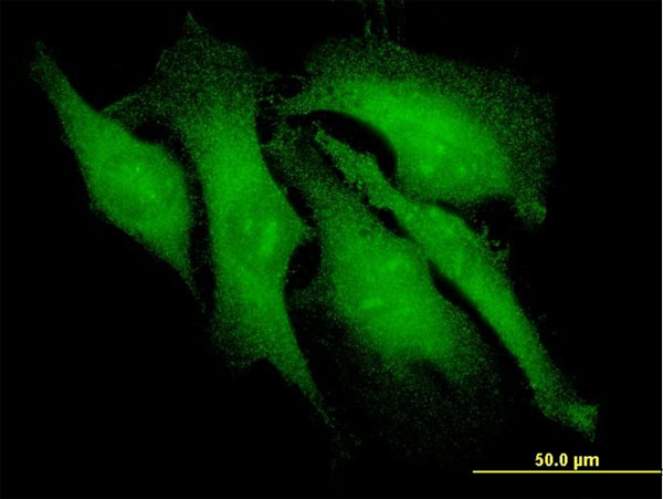 ARRB2 / Beta Arrestin 2 Antibody - Immunofluorescence of monoclonal antibody to ARRB2 on HeLa cell. [antibody concentration 10 ug/ml].