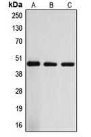ARRDC3 Antibody - Western blot analysis of ARRDC3 expression in Jurkat (A); mouse liver (B); rat liver (C) whole cell lysates.