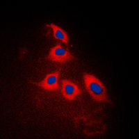 ARRDC3 Antibody - Immunofluorescent analysis of ARRDC3 staining in Jurkat cells. Formalin-fixed cells were permeabilized with 0.1% Triton X-100 in TBS for 5-10 minutes and blocked with 3% BSA-PBS for 30 minutes at room temperature. Cells were probed with the primary antibody in 3% BSA-PBS and incubated overnight at 4 C in a humidified chamber. Cells were washed with PBST and incubated with a DyLight 594-conjugated secondary antibody (red) in PBS at room temperature in the dark. DAPI was used to stain the cell nuclei (blue).