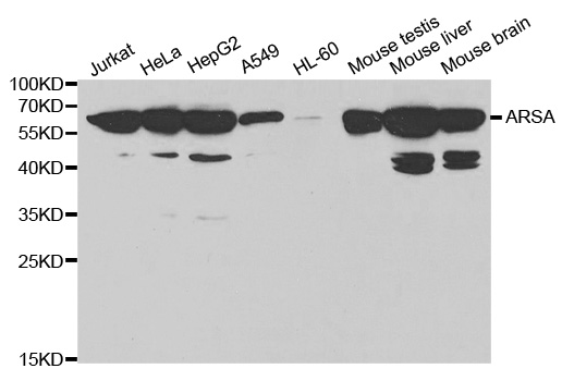 ARSA / Arylsulfatase A Antibody - Western blot analysis of extracts of various cell lines, using ARSA antibody at 1:1000 dilution. The secondary antibody used was an HRP Goat Anti-Rabbit IgG (H+L) at 1:10000 dilution. Lysates were loaded 25ug per lane and 3% nonfat dry milk in TBST was used for blocking.